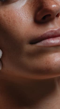 PRP Therapy