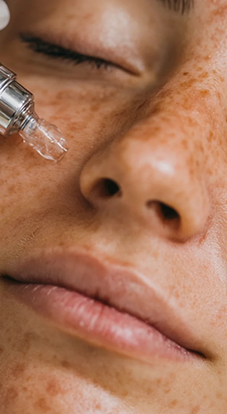 Microneedling