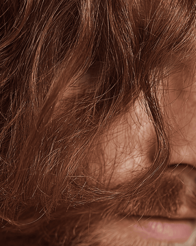 Mesotherapy for Hair